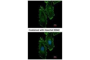 ICC/IF Image Immunofluorescence analysis of methanol-fixed HeLa, using RASGRP4, antibody at 1:500 dilution. (RASGRP4 抗体  (N-Term))