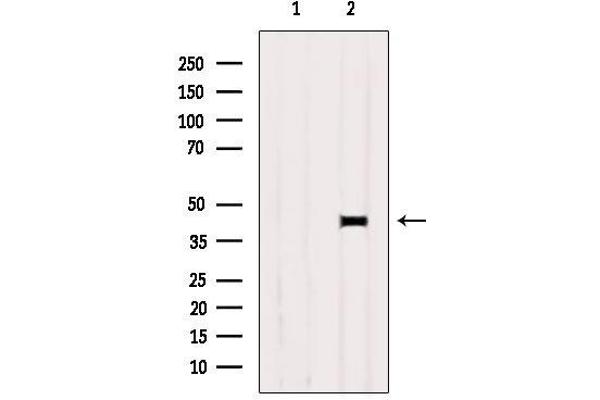 PRLHR 抗体  (Internal Region)