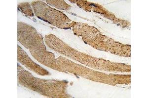 IHC analysis of FFPE human skeletal muscle tissue stained with PDK4 antibody (PDK4 抗体  (AA 83-111))