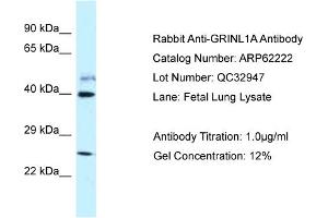 Western Blotting (WB) image for anti-Glutamate Receptor, Ionotropic, N-Methyl D-Aspartate-Like 1A (GRINL1A) (C-Term) antibody (ABIN2789070) (POLR2M 抗体  (C-Term))