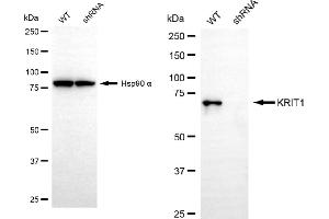 Western blotting analysis using KRIT1 antibody (ABIN7799213).