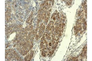 Immunohistochemistry (IHC) image for anti-Peptidyl Arginine Deiminase, Type IV (PADI4) (Center) antibody (ABIN2856939)