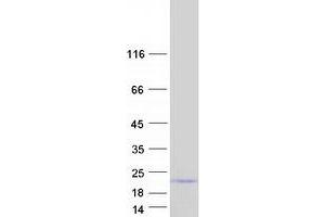 Validation with Western Blot (Neurogranin Protein (NRGN) (Transcript Variant 2) (Myc-DYKDDDDK Tag))