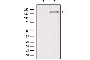 Western blot analysis of extracts from 293, using BAZ2A Antibody. (BAZ2A 抗体  (N-Term))