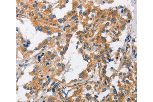 Immunohistochemistry (IHC) image for anti-Charged Multivesicular Body Protein 1A (CHMP1A) antibody (ABIN2423154) (CHMP1A 抗体)