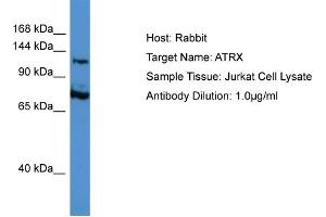 Host: Rabbit Target Name: ATRX Sample Type: Jurkat Whole Cell lysates Antibody Dilution: 1.