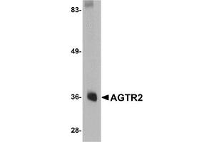 Western Blotting (WB) image for anti-Angiotensin II Receptor, Type 2 (AGTR2) (Middle Region) antibody (ABIN1030845) (Angiotensin II Type 2 Receptor 抗体  (Middle Region))