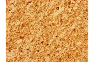 Immunohistochemistry of paraffin-embedded human brain tissue using ABIN7159593 at dilution of 1:100 (MARS2 抗体  (AA 225-460))
