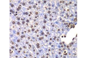 Immunohistochemistry of paraffin-embedded Mouse liver using ULK4 Polyclonal Antibody at dilution of 1:100 (40x lens). (ULK4 抗体)