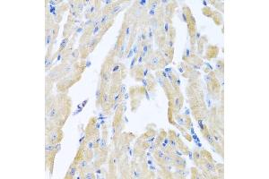 Immunohistochemistry of paraffin-embedded mouse heart using MLN antibody (ABIN6128307, ABIN6143890, ABIN6143891 and ABIN6222013) at dilution of 1:100 (40x lens). (Motilin 抗体  (AA 26-115))