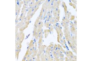 Immunohistochemistry of paraffin-embedded mouse heart using MLN antibody (ABIN6128307, ABIN6143890, ABIN6143891 and ABIN6222013) at dilution of 1:100 (40x lens). (Motilin 抗体  (AA 26-115))