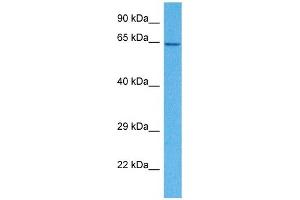 Host:  Rabbit  Target Name:  SLC15A4  Sample Tissue:  Human HepG2 Whole Cell  Antibody Dilution:  1ug/ml (SLC15A4 抗体  (N-Term))