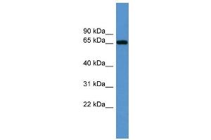 WB Suggested Anti-Igf2bp3 Antibody Titration:  0. (IGF2BP3 抗体  (Middle Region))