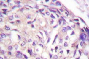 Immunohistochemistry analysis with AurA (pPro282) antibody on paraffin sections. (Aurora A 抗体)