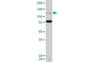 MAML3 polyclonal antibody (A01), Lot # 051012JC01 Western Blot analysis of MAML3 expression in MES-SA/Dx5 .