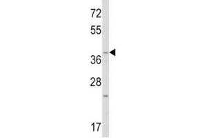 Western blot analysis of WNT1 antibody and mouse heart tissue lysate.