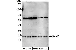 Western Blotting (WB) image for anti-Mesencephalic Astrocyte-Derived Neurotrophic Factor (MANF) (AA 1-50) antibody (ABIN7453129)