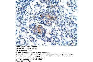 Human Pancreas (P2RX1 抗体  (Middle Region))
