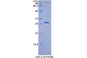 SDS-PAGE analysis of Human ADAM9 Protein. (ADAM9 蛋白)