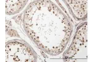 Immunoperoxidase of monoclonal antibody to USP29 on formalin-fixed paraffin-embedded human testis. (USP29 抗体  (AA 131-240))