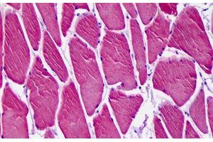 Anti-CAMK1D antibody IHC staining of human skeletal muscle. (CAMK1D 抗体  (AA 1-96))