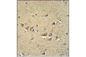 Immunohistochemistry (Paraffin-embedded Sections) (IHC (p)) image for anti-Sodium Channel, Voltage-Gated, Type I, beta (SCN1B) (AA 70-98), (N-Term) antibody (ABIN954692)