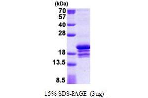 SDS-PAGE (SDS) image for Polymerase (DNA Directed), epsilon 3 (p17 Subunit) (POLE3) (AA 1-147) protein (His tag) (ABIN5853016) (POLE3 Protein (AA 1-147) (His tag))