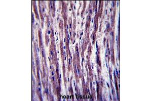 Immunohistochemistry (Paraffin-embedded Sections) (IHC (p)) image for anti-Protein Tyrosine Phosphatase-Like (Proline Instead of Catalytic Arginine), Member A (PTPLA) (AA 37-66), (N-Term) antibody (ABIN657409)