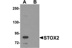 Western blot analysis of STOX2 in human kidney tissue lysate with STOX2 antibody at 1 μg/ml in (A) the absence and (B) the presence of blocking peptide. (STOX2 抗体  (C-Term))