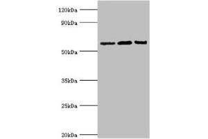 Western blot All lanes: Interleukin-10 receptor subunit alpha antibody at 8 μg/mL Lane 1: Mouse heart tissue Lane 2: Hela whole cell lysate Lane 3: Mouse liver tissue Secondary Goat polyclonal to rabbit IgG at 1/10000 dilution Predicted band size: 63 kDa Observed band size: 63 kDa