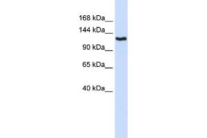 WB Suggested Anti-IGSF1 Antibody Titration:  0. (IGSF1 抗体  (N-Term))