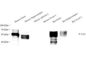 Western blot analysis of phospho-TAU (S202/T205) (ABIN7075838) at dilution of 1: 1000 (tau 抗体  (pSer202, pThr205))