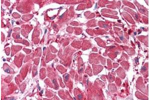Human Heart: Formalin-Fixed, Paraffin-Embedded (FFPE) (ACOT9 抗体  (AA 1-213))