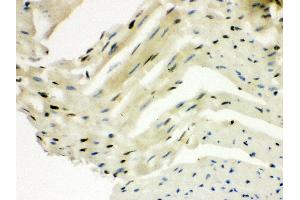 Anti- SLUG Picoband antibody,IHC(P) IHC(P): Mouse Cardiac Muscle Tissue (SLUG 抗体  (Middle Region))
