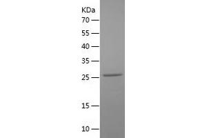 TNNI3 Protein (AA 2-211) (His tag)