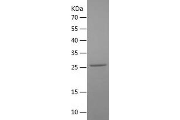 TNNI3 Protein (AA 2-211) (His tag)