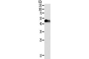 Gel: 12 % SDS-PAGE, Lysate: 40 μg, Lane: Human fetal kidney tissue, Primary antibody: ABIN7131078(SLC12A1 Antibody) at dilution 1/200, Secondary antibody: Goat anti rabbit IgG at 1/8000 dilution, Exposure time: 1 minute (SLC12A1 抗体)