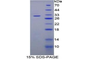 SDS-PAGE analysis of Rat Matrix Metalloproteinase 8 (MMP8) Protein. (MMP8 蛋白)