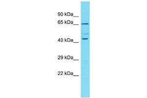 Host: Rabbit  Target Name: Mapk11  Sample Tissue: Rat Pancreas lysates  Antibody Dilution: 1. (MAPK11 抗体  (N-Term))