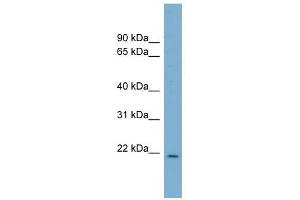 CUTA antibody used at 1 ug/ml to detect target protein. (CUTA 抗体)