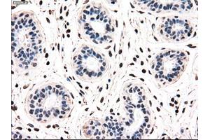 Immunohistochemical staining of paraffin-embedded breast tissue using anti-NRBP1 mouse monoclonal antibody. (NRBP1 抗体)