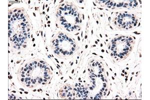 Immunohistochemical staining of paraffin-embedded breast tissue using anti-NRBP1 mouse monoclonal antibody.