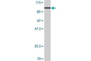 Western Blot detection against Immunogen (97. (FUBP1 抗体  (AA 1-653))