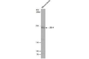 WB Image Mouse tissue extract (50 μg) was separated by 5% SDS-PAGE, and the membrane was blotted with ZO-1 antibody [N1N2], N-term , diluted at 1:500. (TJP1 抗体  (N-Term))