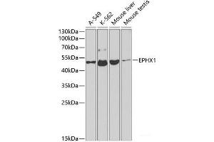 Western blot analysis of extracts of various cell lines using EPHX1 Polyclonal Antibody at dilution of 1:1000. (EPHX1 抗体)