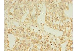Immunohistochemistry of paraffin-embedded human adrenal gland tissue using ABIN7158414 at dilution of 1:100 (LDAH/C2orf43 抗体  (AA 1-325))