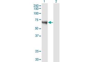Western Blot analysis of CAMKK1 expression in transfected 293T cell line by CAMKK1 monoclonal antibody (M02), clone 4B4. (CAMKK1 抗体  (AA 2-100))