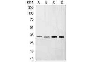 Western blot analysis of Ephrin B3 expression in HepG2 (A), NIH3T3 (B), mouse liver (C), rat liver (D) whole cell lysates. (Ephrin B3 抗体  (C-Term))