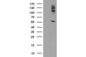Western Blotting (WB) image for anti-Lipase, Endothelial (LIPG) antibody (ABIN1499172) (LIPG 抗体)