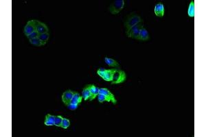 Immunofluorescent analysis of MCF-7 cells using ABIN7153625 at dilution of 1:100 and Alexa Fluor 488-congugated AffiniPure Goat Anti-Rabbit IgG(H+L) (GJB6 抗体  (AA 216-261))